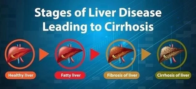 Cirrosis Hepática: Síntomas, Causas y Tratamiento