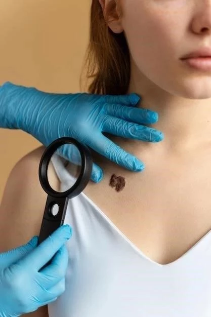 Título: Melanoma Acral Lentiginoso: Síntomas, Tipos y Más