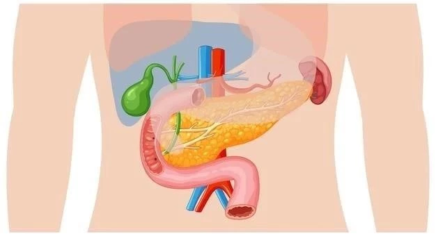 Enfermedad Inflamatoria Intestinal (EII)⁚ Una Visión General