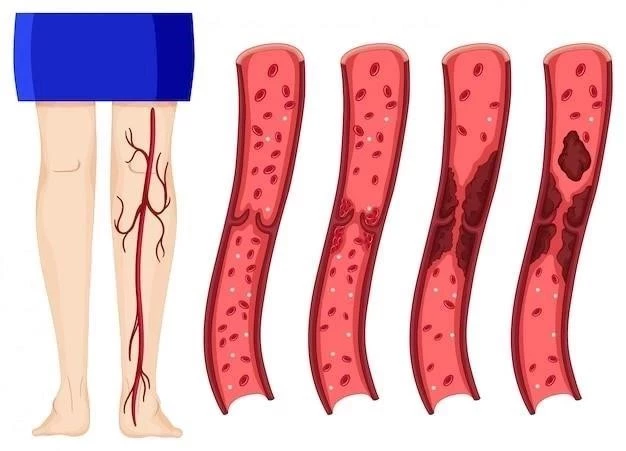 Vena Cava Superior: Anatomía y Condiciones Relacionadas